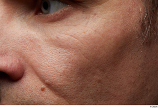 HD Face skin references Emery Hewitt cheek skin pores skin…